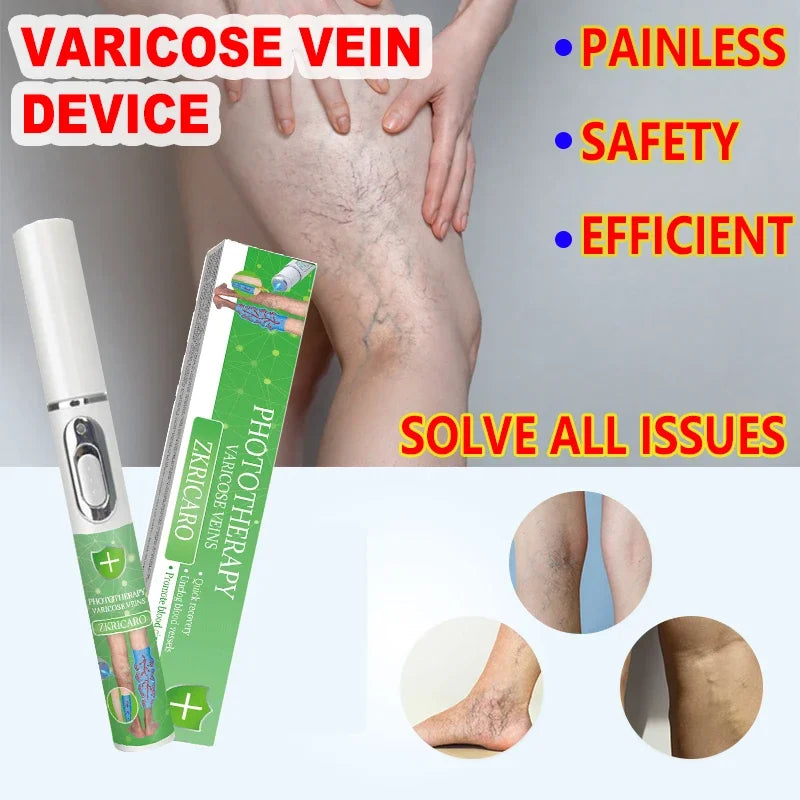 High tech Laser therapy improves moderate varicose veins relieves pain and Improves circulation for men women - Supersell