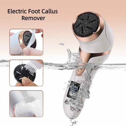 Electric Foot Callus Remover – Rechargeable Pedicure Tool - Supersell