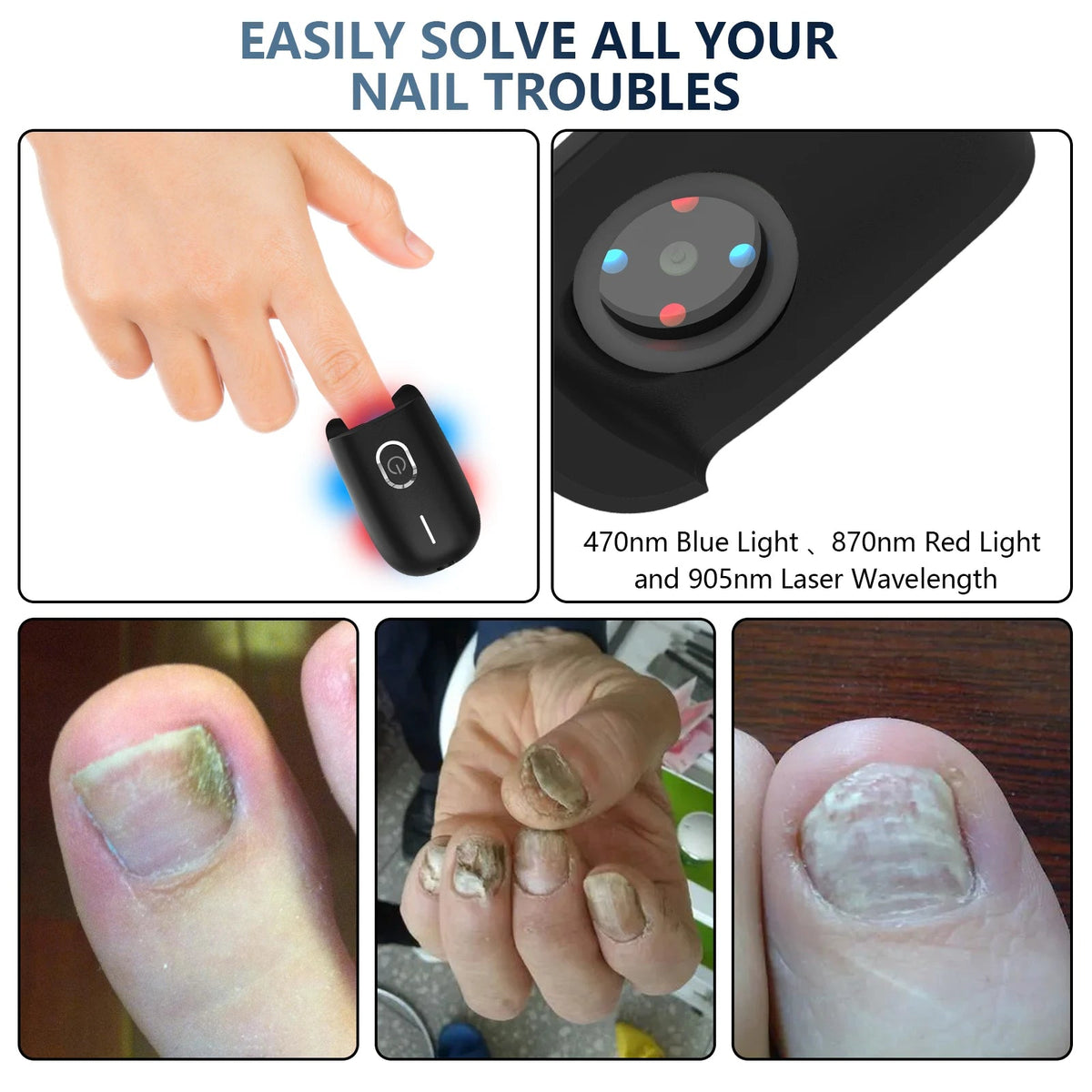 Toenail Machine KTS Nail Fungus Laser Device Toenail Laser Therapy Machine