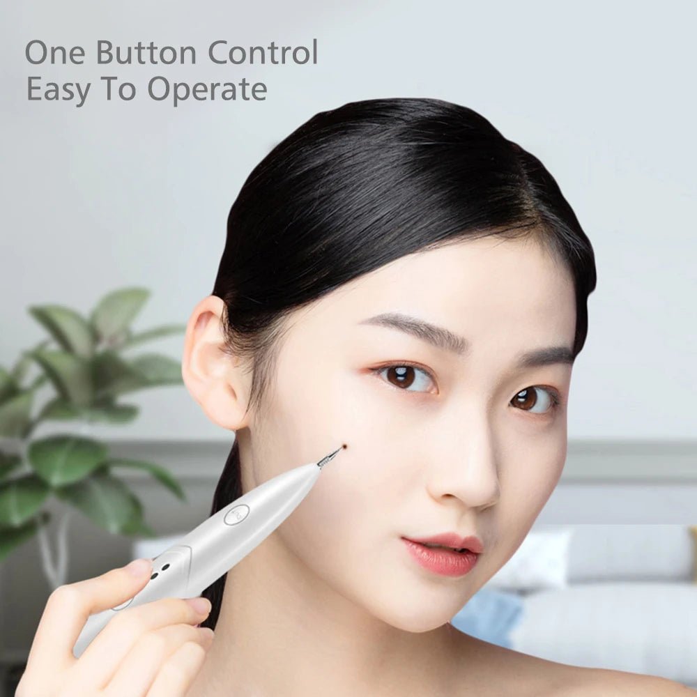 Mini Plasma Laser Pen – Freckle, Wart & Skin Tag Remover Tool - Supersell