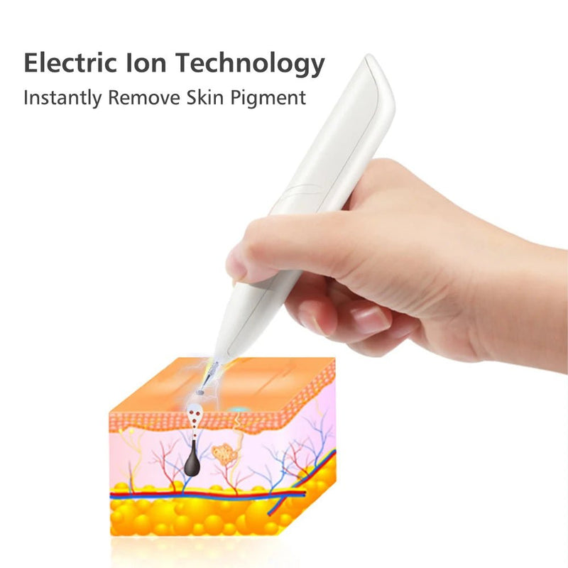 Mini Plasma Laser Pen – Freckle, Wart & Skin Tag Remover Tool - Supersell